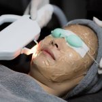 Tindakan Teknologi Laser Pada Perawatan Wajah Seseorang